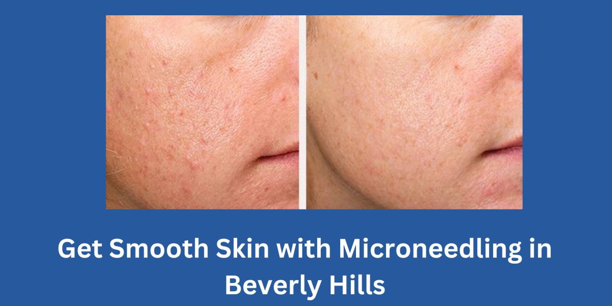 Get Smooth Skin with Microneedling in Beverly Hills