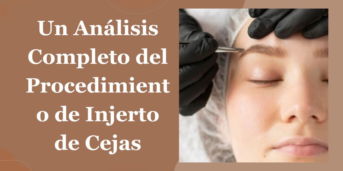 Un Análisis Completo del Procedimiento de Injerto de Cejas